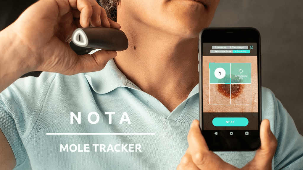 NOTA Mole Tracker Screenshot
